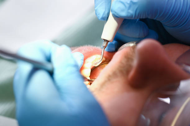 Best Emergency Dental Surgery in Prescott, AR