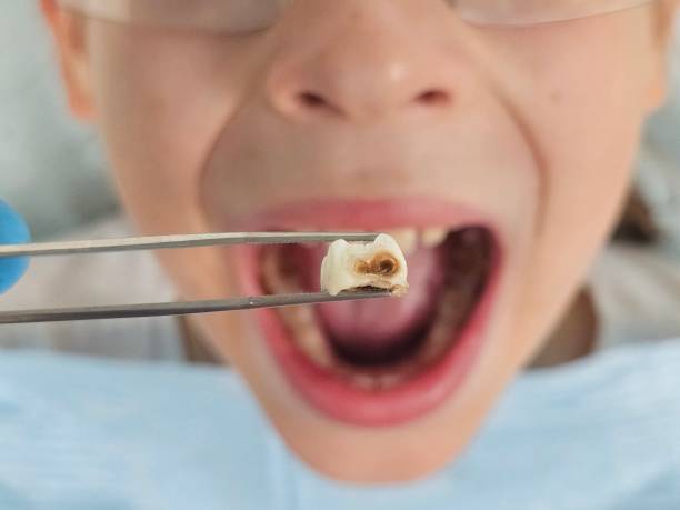 Best Same-Day Emergency Dentist in Prescott, AR